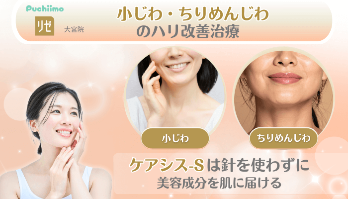 リゼクリニック大宮美肌治療小じわ・ちりめんじわのハリ改善治療