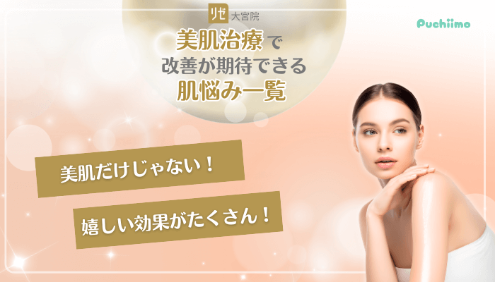 リゼクリニック大宮美肌治療改善が期待できる肌悩み