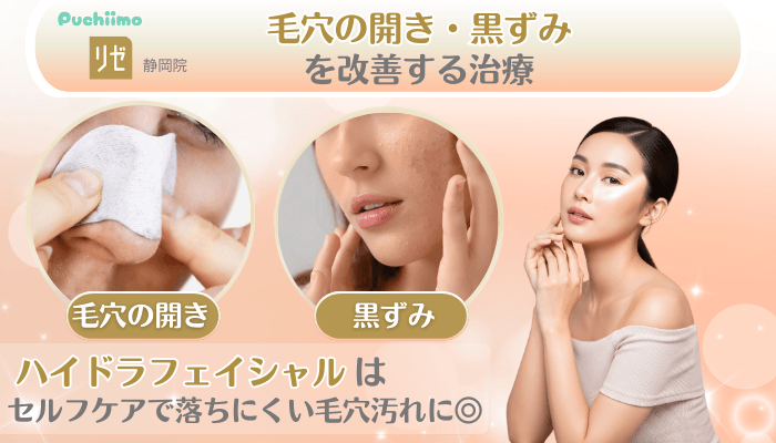 リゼクリニック静岡美肌治療毛穴の開き・黒ずみを改善する治療