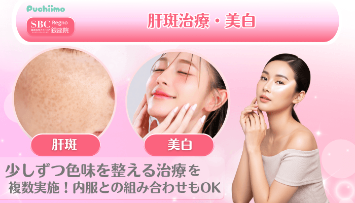SBCRegno銀座美肌治療肝斑治療・美白