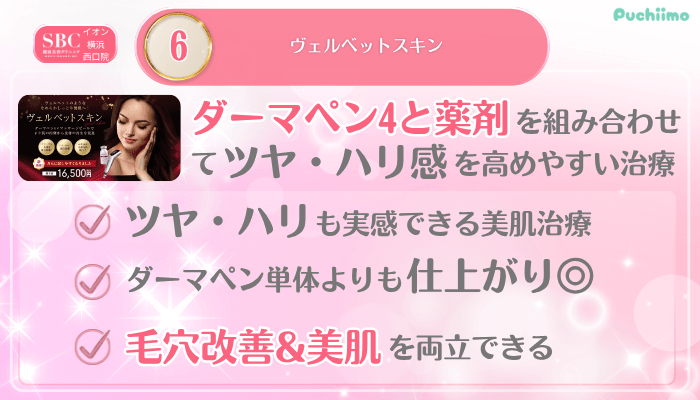 SBCイオン横浜西口美肌治療メイン施術6