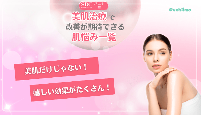 SBC八王子美肌治療改善が期待できる肌悩み