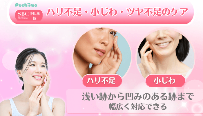 SBC小田原美肌治療ハリ不足・小じわ・ツヤ不足のケア