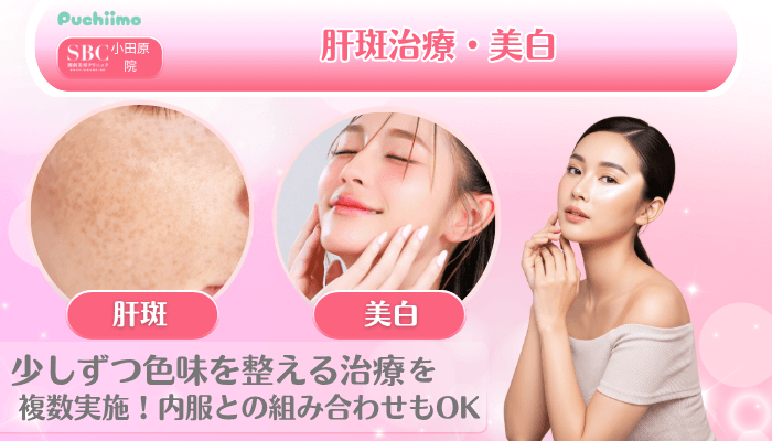 SBC小田原美肌治療肝斑治療・美白