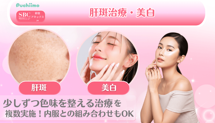 SBC新宿アネックス24美肌治療肝斑治療・美白