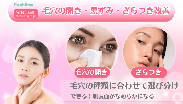 SBC新宿南口美肌治療毛穴の開き・黒ずみ・ざらつき改善