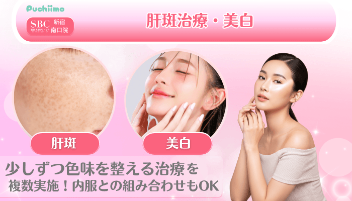 SBC新宿南口美肌治療肝斑治療・美白