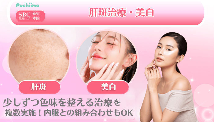 SBC新宿美肌治療肝斑治療・美白