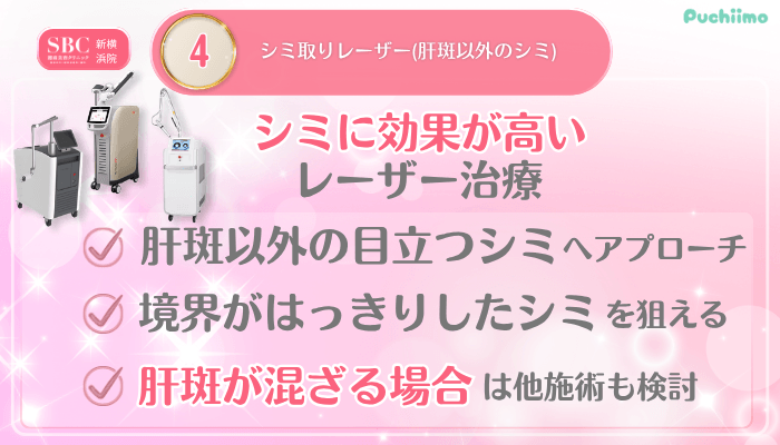 SBC新横浜美肌治療メイン施術4