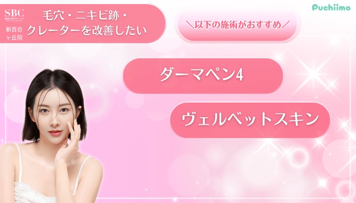 SBC新百合ヶ丘美肌治療毛穴・ニキビ跡・クレーターを改善したい方