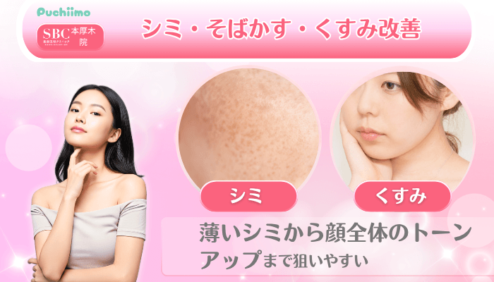SBC本厚木美肌治療シミ・そばかす・くすみ改善