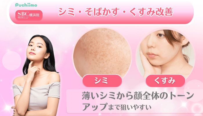 SBC横浜美肌治療シミ・そばかす・くすみ改善