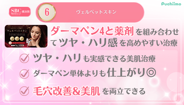 SBC横浜美肌治療メイン施術6