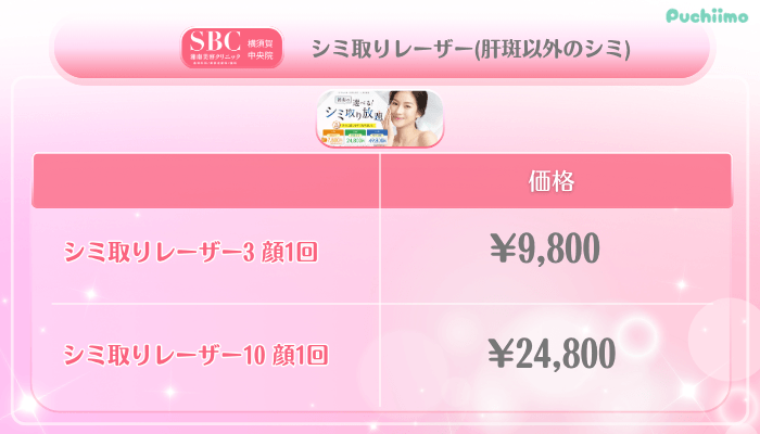 SBC横須賀中央美肌治療シミ取りレーザー肝斑以外のシミ料金