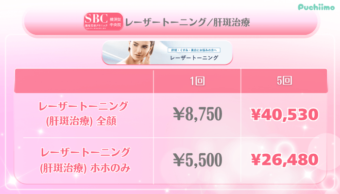 SBC横須賀中央美肌治療レーザートーニング_肝斑治療料金