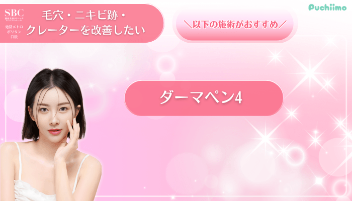 SBC池袋メトロポリタン口美肌治療毛穴・ニキビ跡・クレーターを改善したい方