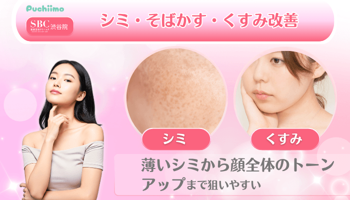 SBC渋谷美肌治療シミ・そばかす・くすみ改善