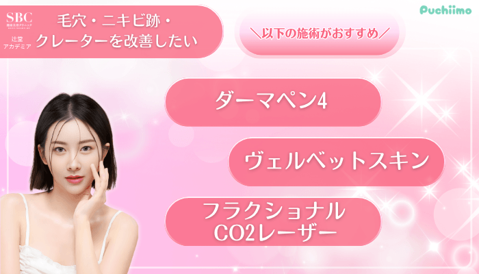 SBC辻堂アカデミア美肌治療毛穴・ニキビ跡・クレーターを改善したい方