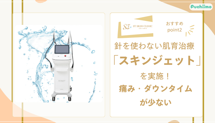 STスキンクリニック青山肌育治療おすすめポイント2