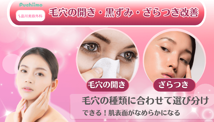 品川美容外科美肌治療毛穴の開き・黒ずみ・ざらつき改善
