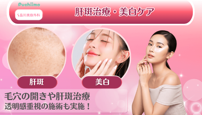 品川美容外科美肌治療肝斑治療・美白ケア