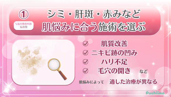 品川美容外科仙台美肌治療受ける前に確認すべきポイント1