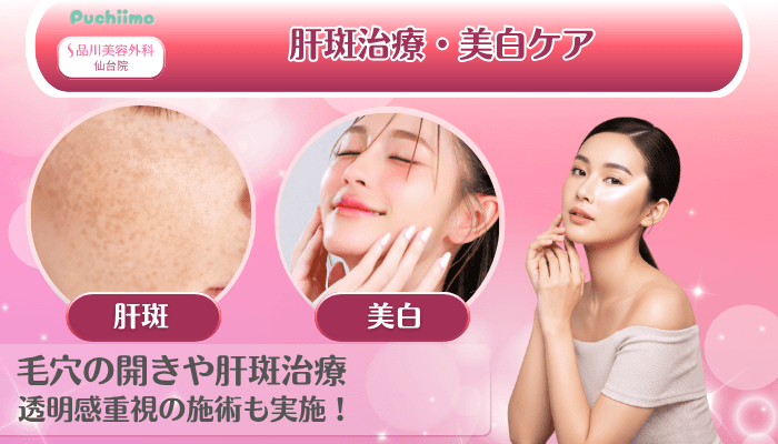 品川美容外科仙台美肌治療肝斑治療・美白ケア