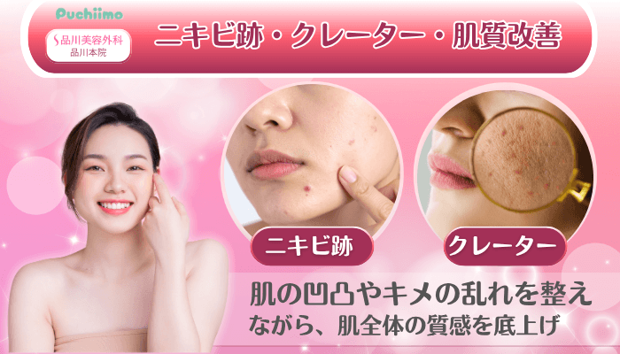 品川美容外科品川美肌治療ニキビ跡・クレーター・肌質改善
