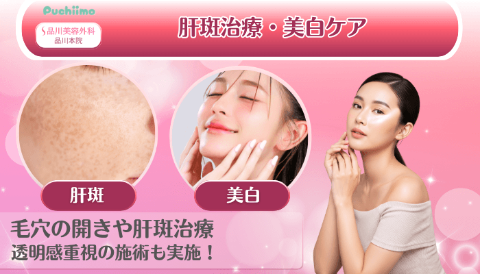 品川美容外科品川美肌治療肝斑治療・美白ケア