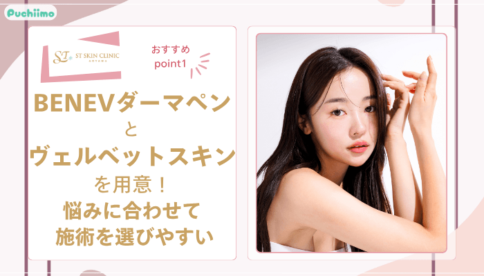 STスキンクリニック青山ダーマペンおすすめポイント1