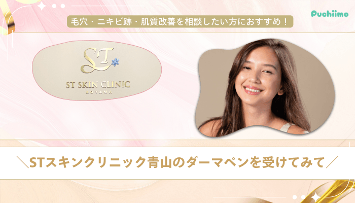 STスキンクリニック青山ダーマペンまとめ