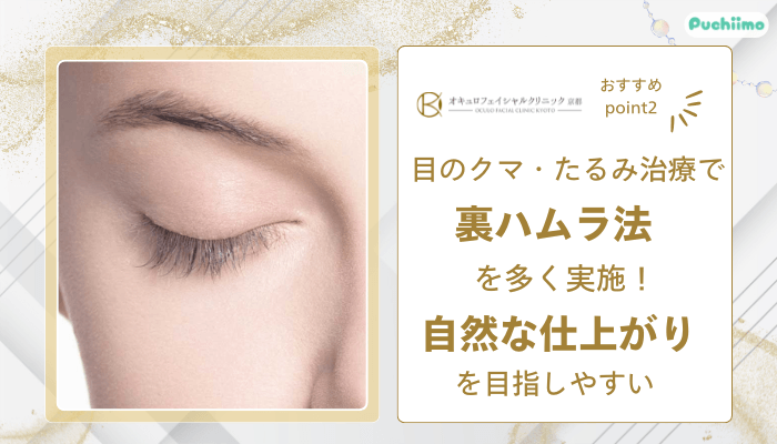 オキュロフェイシャルクリニック京都クマ・たるみ取りおすすめポイント2