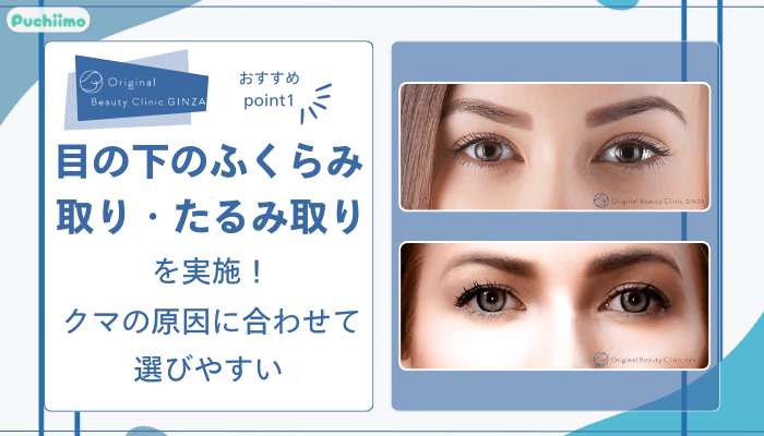 Original-Beauty-Clinic-GINZAクマ取りおすすめポイント1