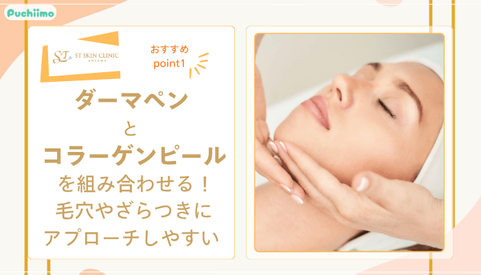 STスキンクリニック青山ヴェルベットスキンおすすめポイント1