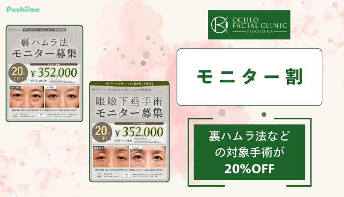 オキュロフェイシャルクリニック福岡クマ・たるみ取りモニター割