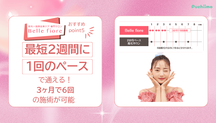 ベルフィオーレ脱毛おすすめポイント5