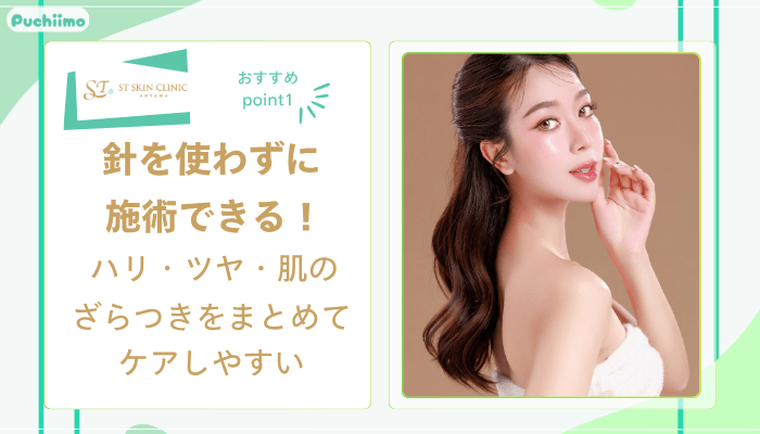STスキンクリニック青山コラーゲンピールおすすめポイント1