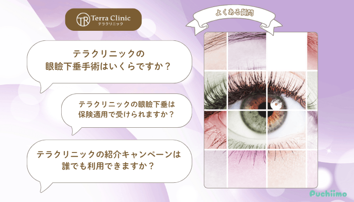 テラクリニック眼瞼下垂よくある質問